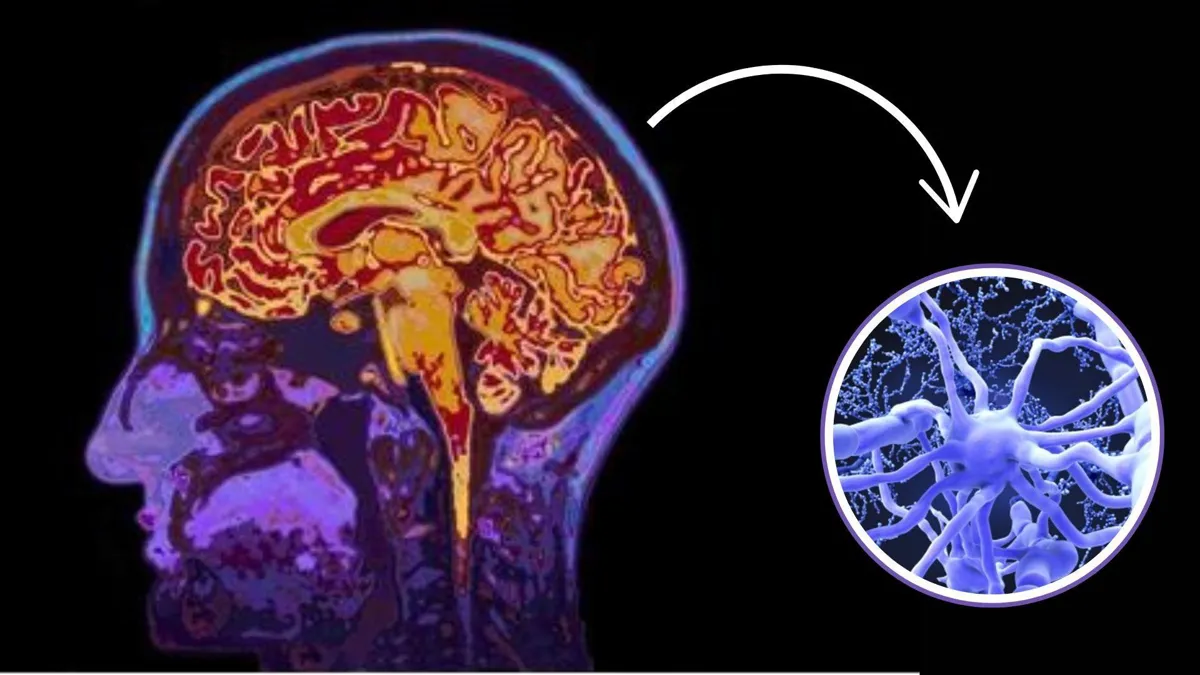 A colored scan of a brain/A close-up photograph of oligodendrocytes in the brain