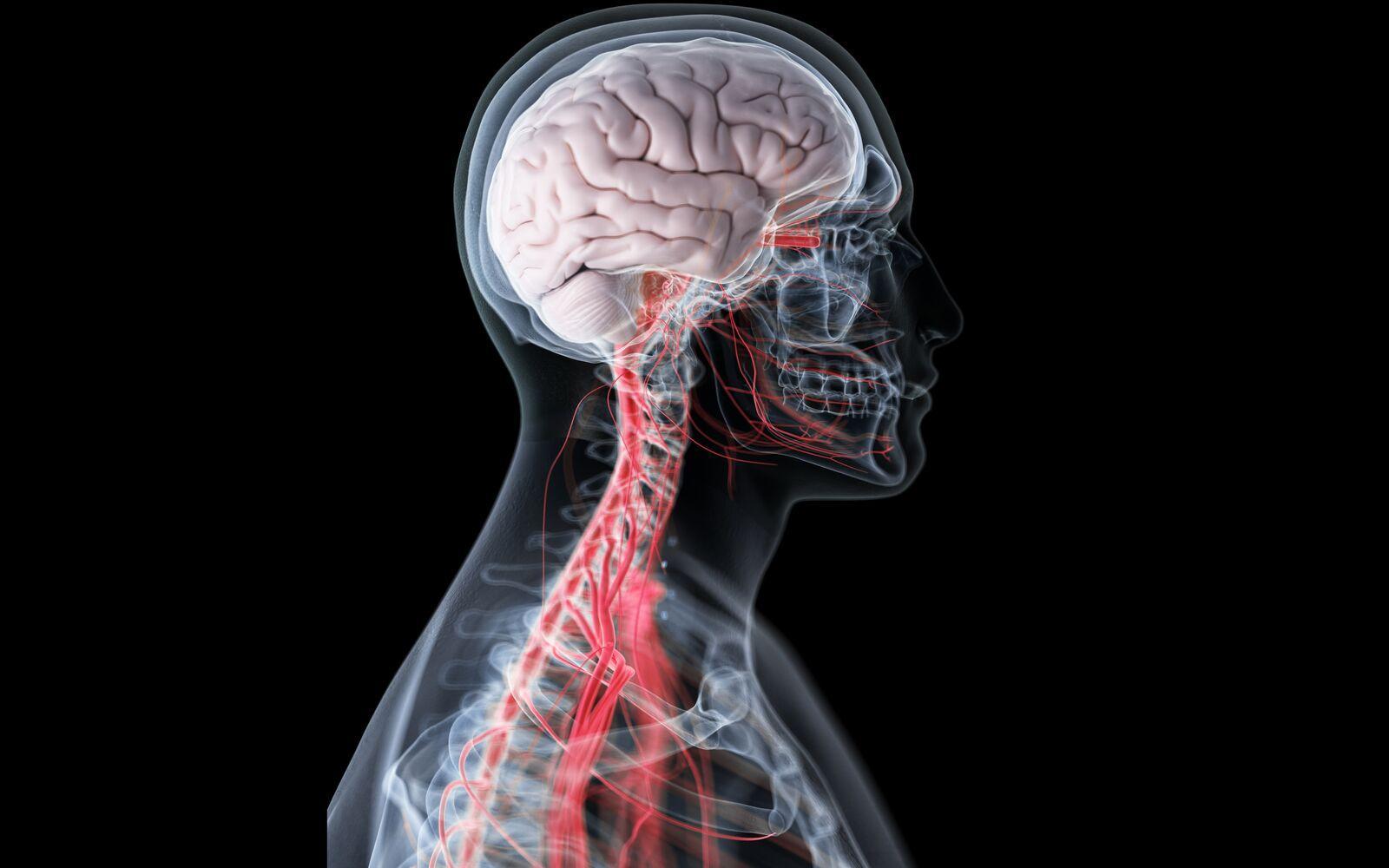 Illustrative archive brain image; not a newly reported participant scan.