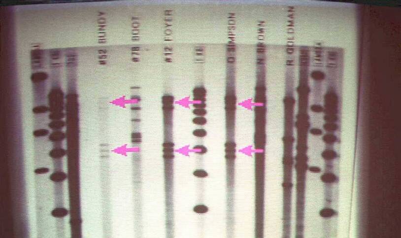 Laboratory bands on a genetic-testing image, an illustration rather than the Kelly study’s results