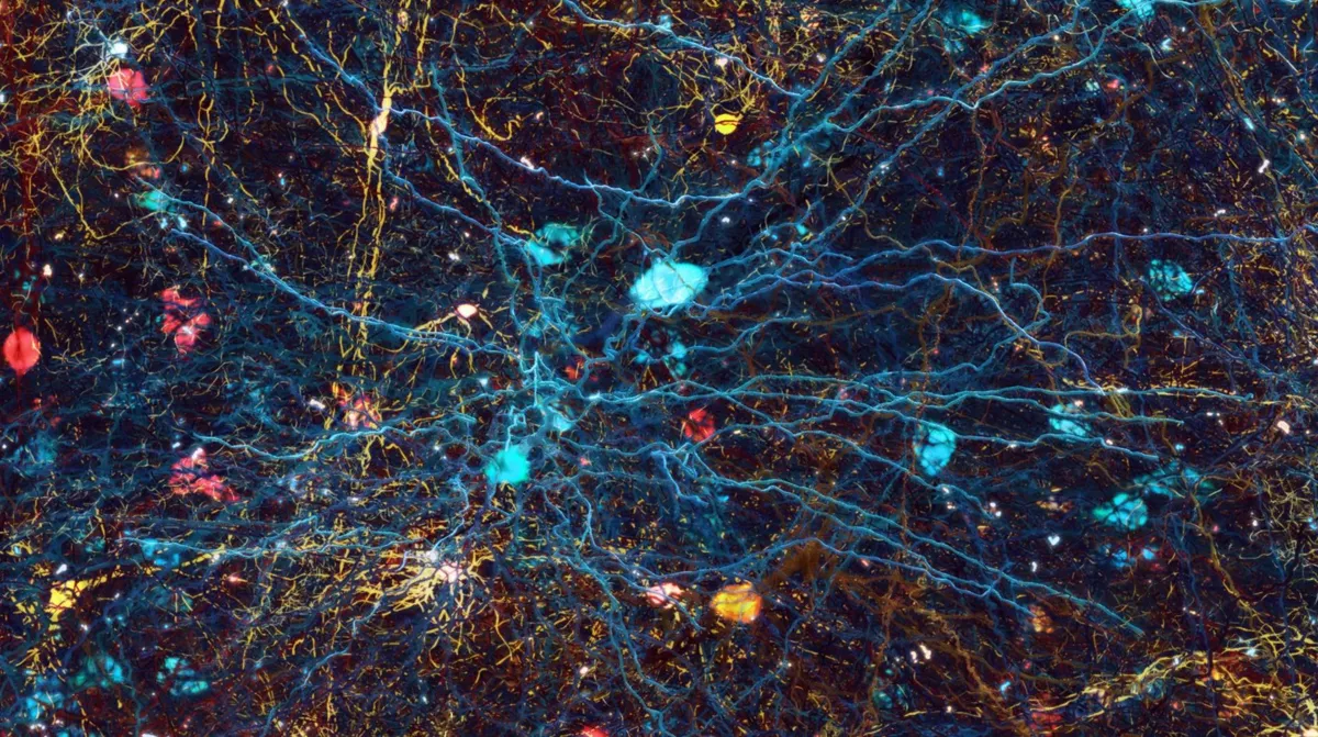 An illustration of a map of the brain’s neural pattern