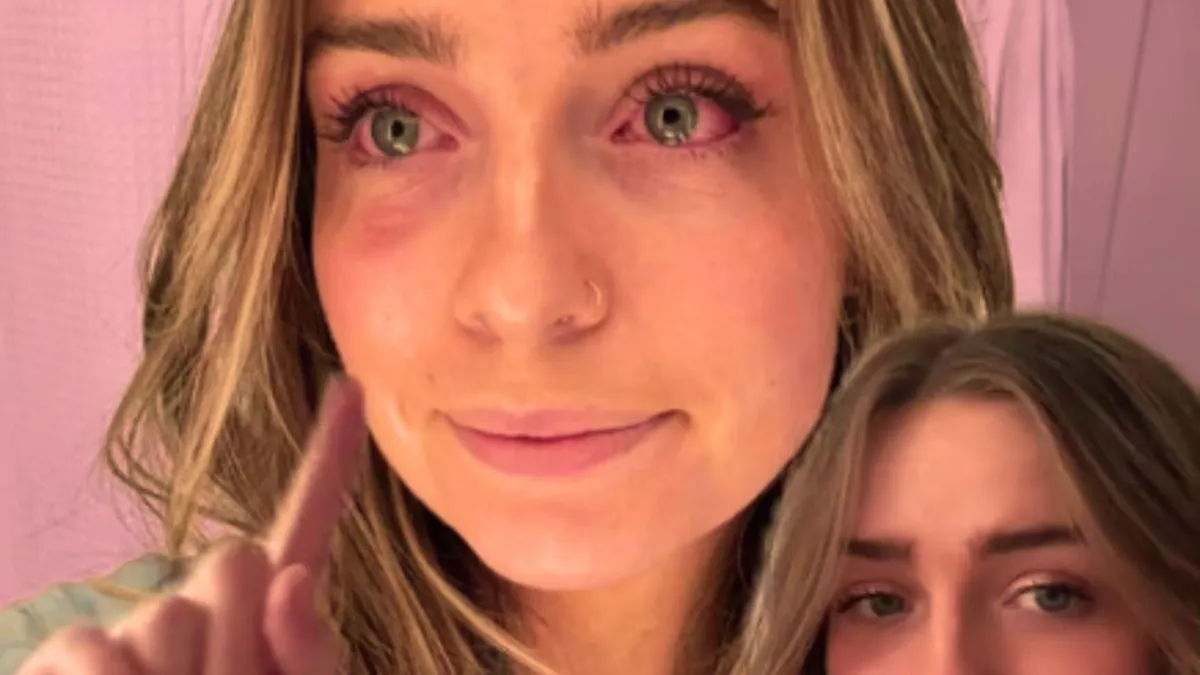 A screenshot of a TikTok video by user @FormerVegetarian