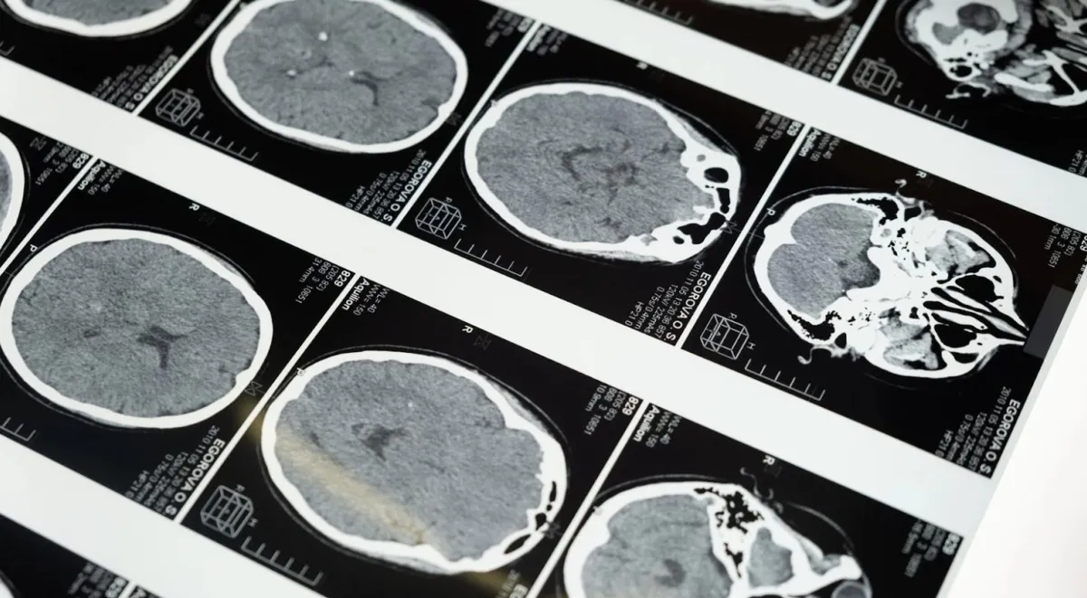 Some brain scans of different areas of the brain.