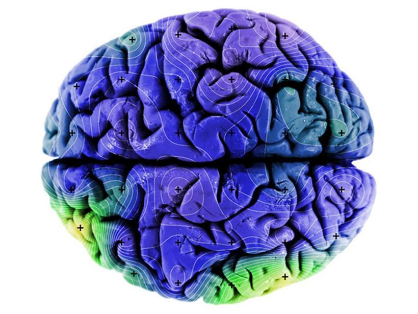 Illustrative archive brain image; not a newly reported participant scan.