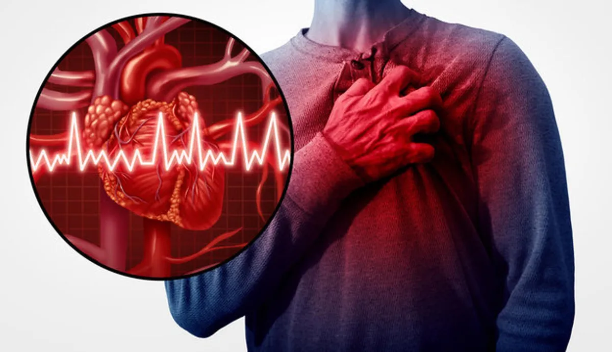A faceless man holding his chest, signifying a heart attack, with a digital illustration of a heart