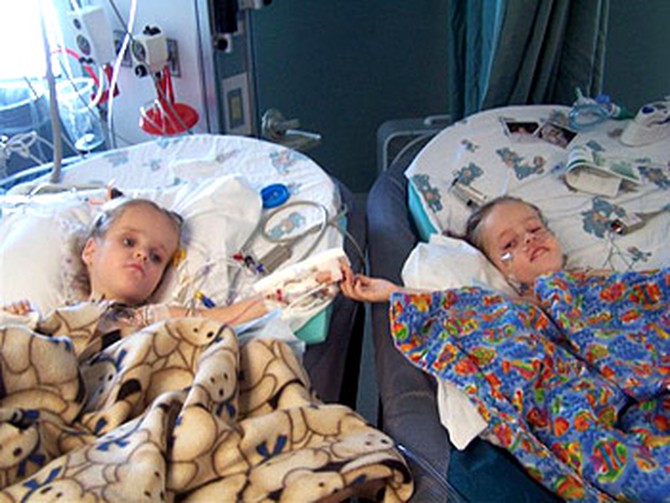 The twins in separate hospital beds after their operation