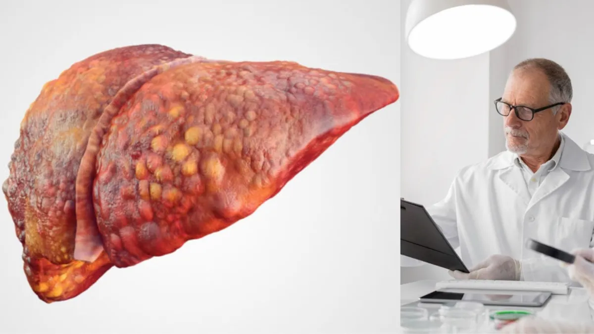 A photo illustration of a liver suffering from cirrhosis/Several researchers are pictured working on a study in their lab