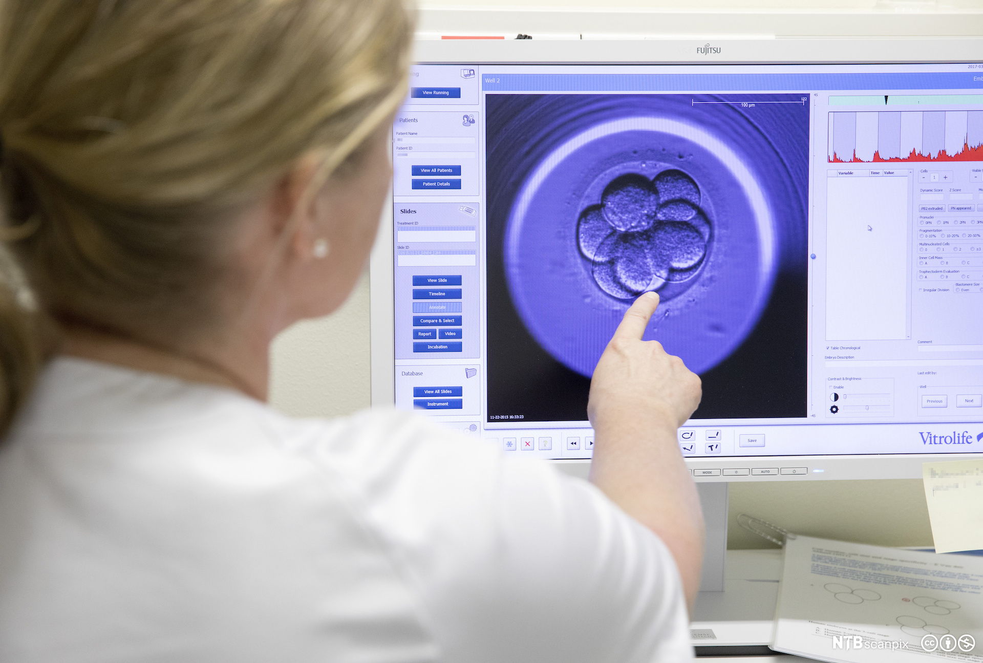 A clinician pointing to an embryo image on a screen