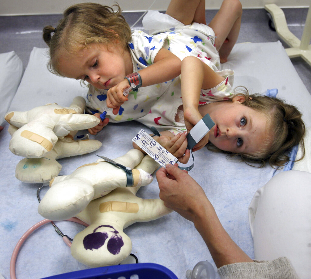 The twins resting together in a hospital bed before separation