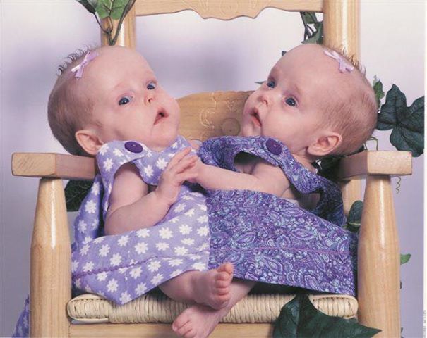 The Herrin twins seated together as infants