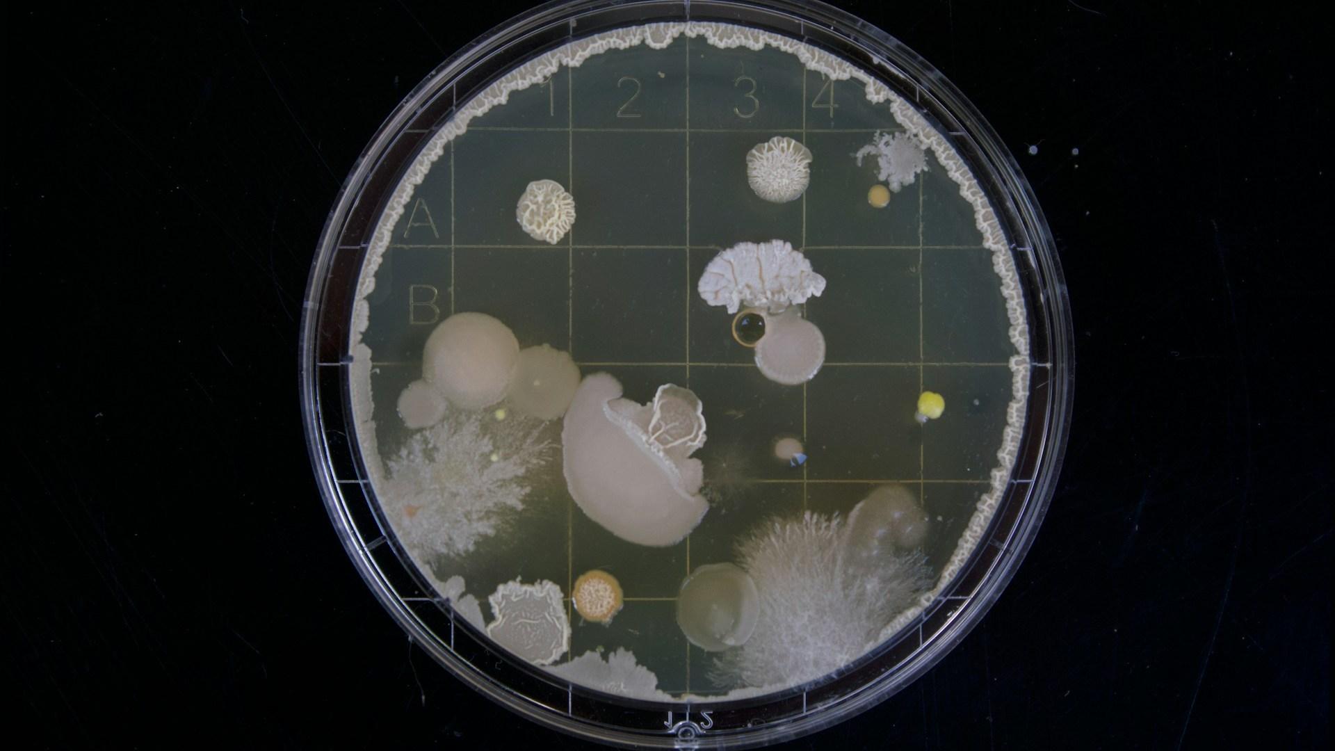 A laboratory culture dish; illustrative archive image, not evidence of bacteria in this recall.
