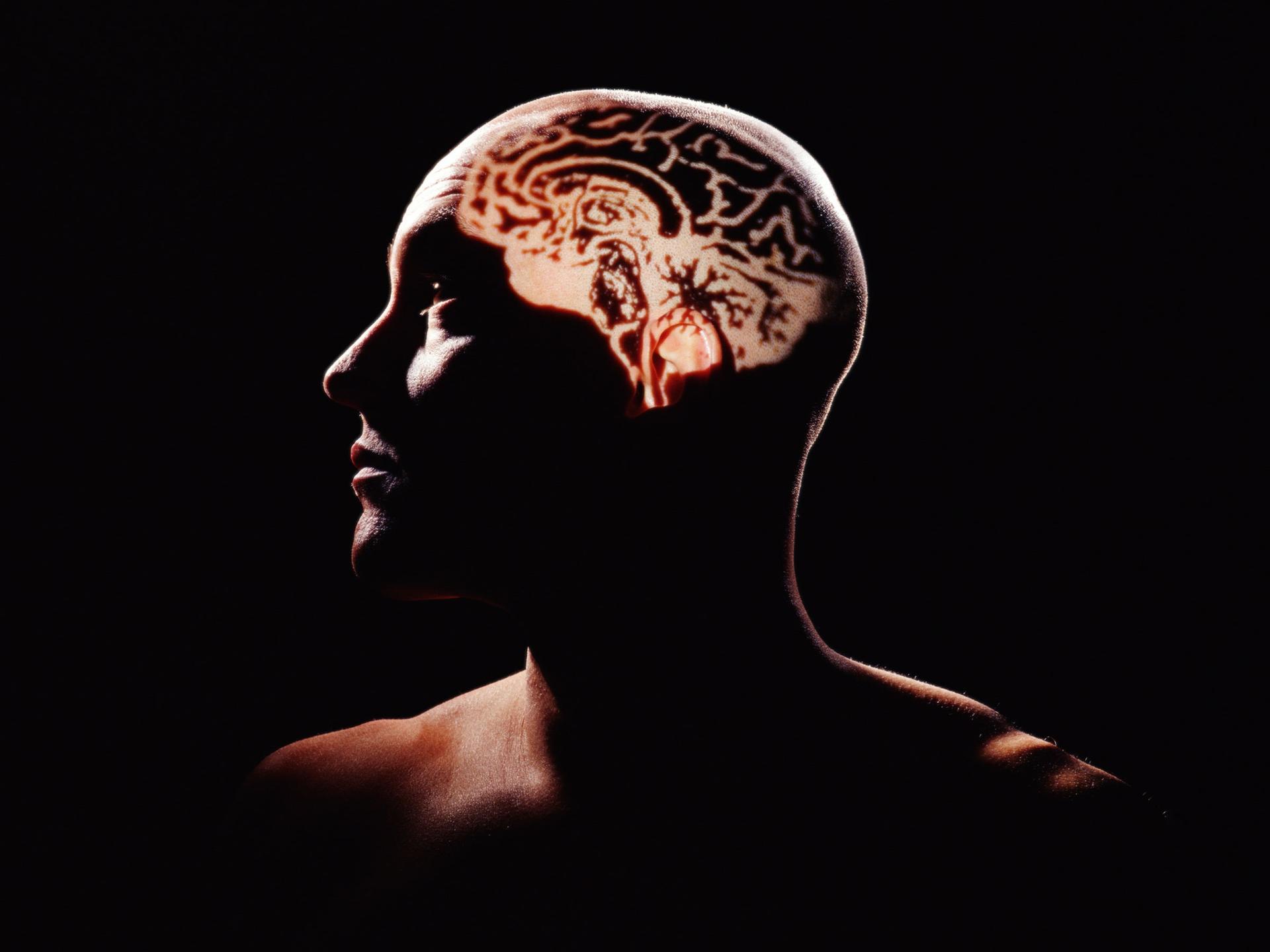 Illustrative archive brain image; not a newly reported participant scan.