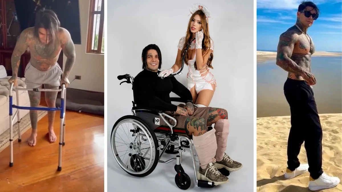 Man After Leg-Lengthening Surgery