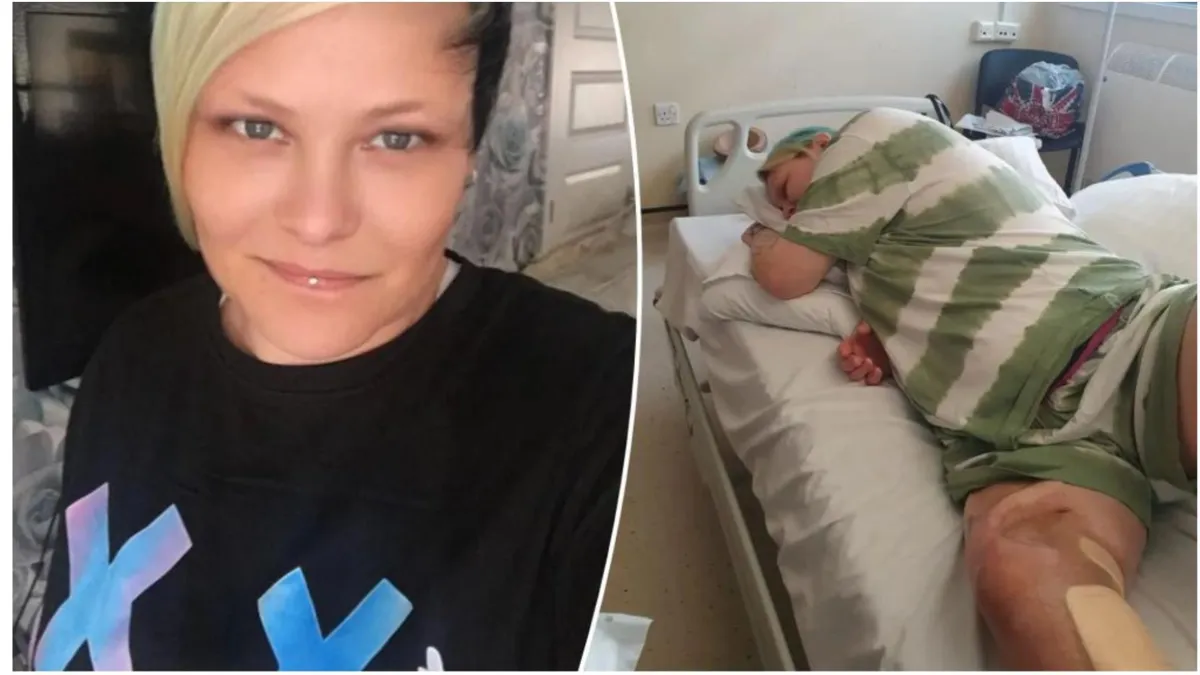 A collage of 40-year-old Michelle Milton before and after her fish hook injury