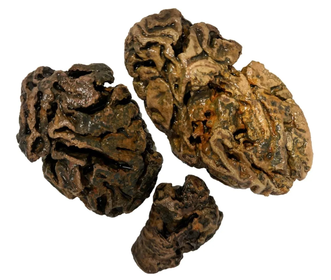 An image of several preserved brains taken from the library of Morton-Hayward