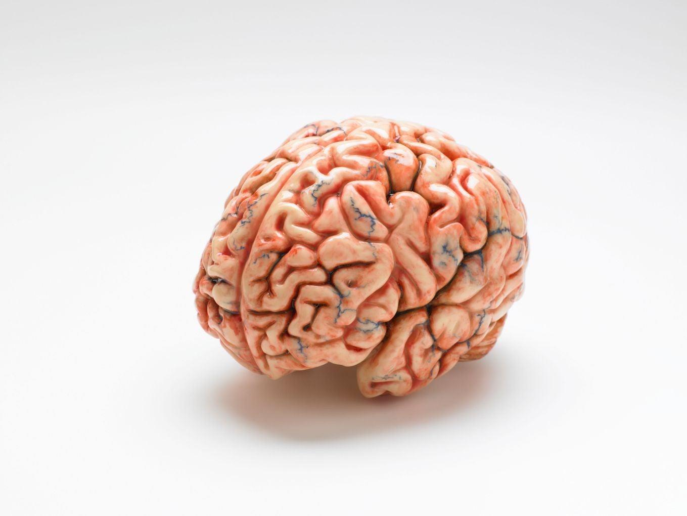 Illustrative archive brain image; not a newly reported participant scan.