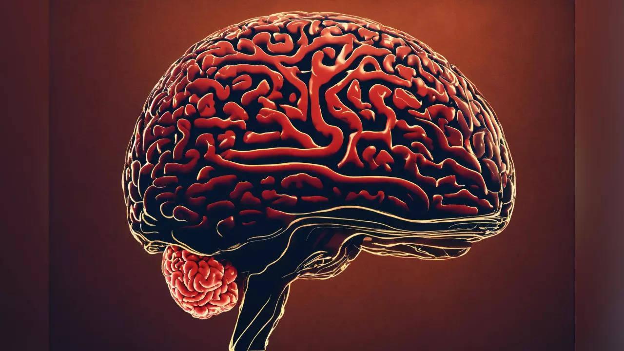 Illustrative archive brain image; not a newly reported participant scan.
