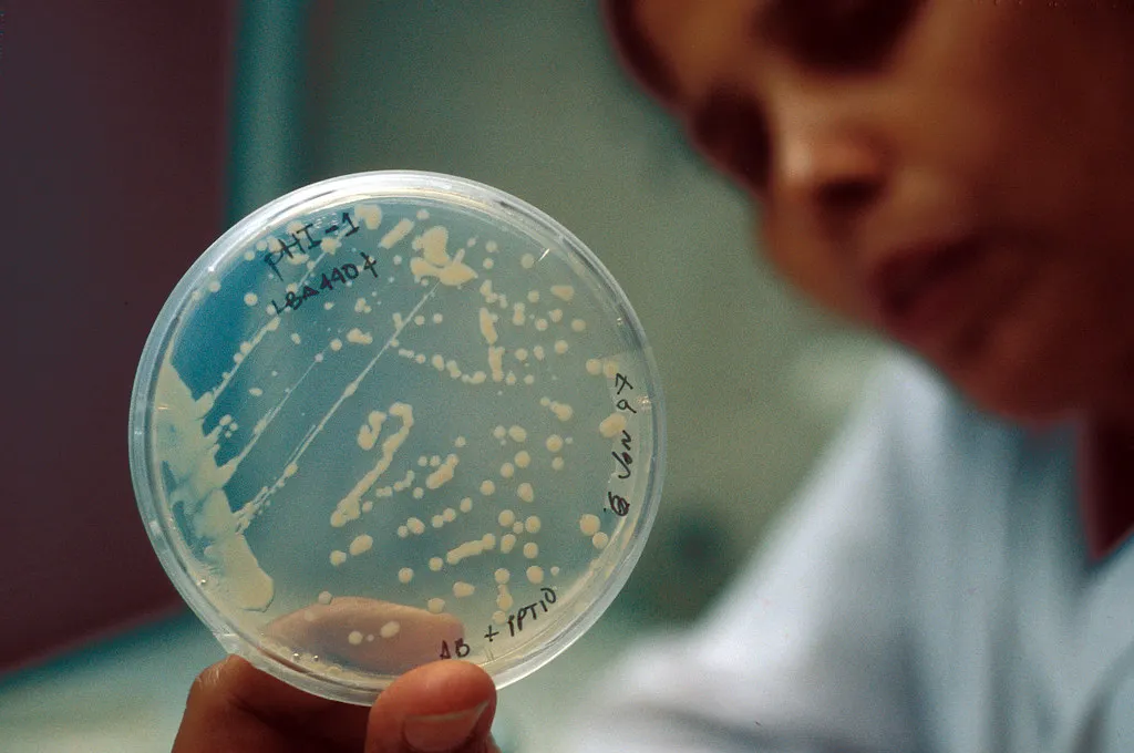 A person in a lab coat holding a bacteria sample in a petri dish
